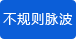 檢測脈搏不規則的異常情況